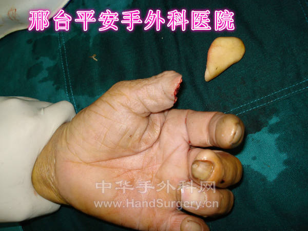 DSC04223_meitu_2.jpg
