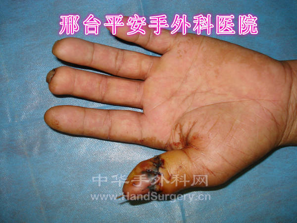 DSC04228_meitu_5.jpg