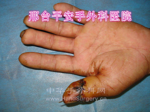 DSC04229_meitu_6.jpg