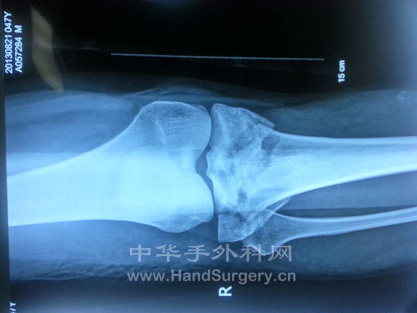 20130821_193414.jpg