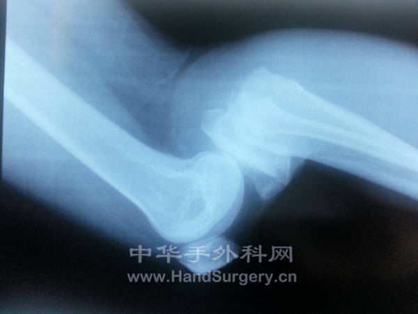20130821_193446.jpg