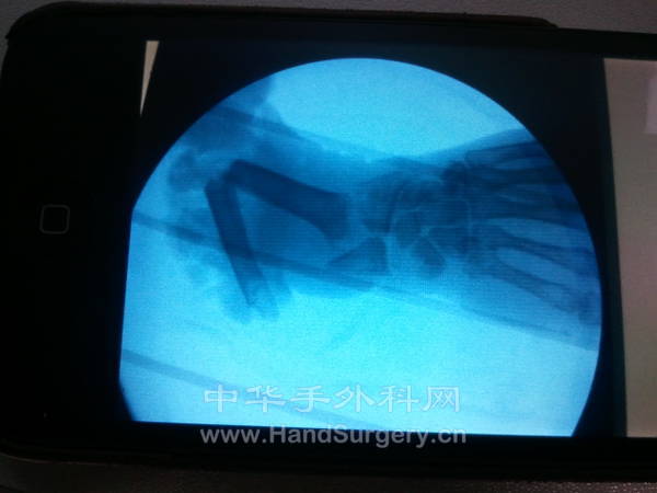 2012-12-04 17.16.19.jpg
