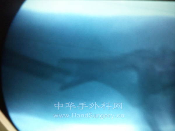2012-12-04 17.16.58.jpg