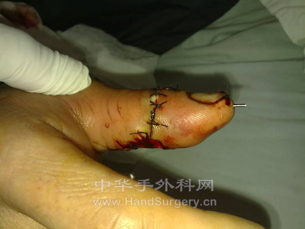 20130105149.jpg