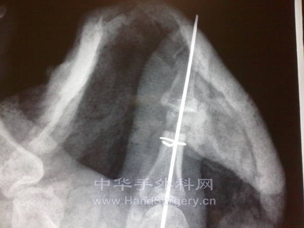 20130107204.jpg