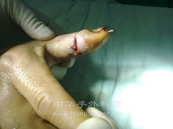 20130118269.jpg