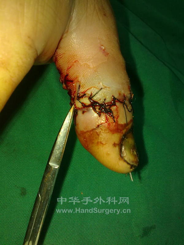20130118279.jpg