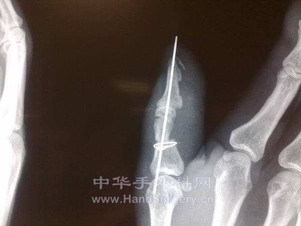20130123322.jpg