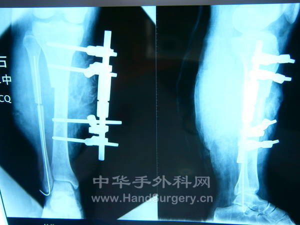 杨楚-62814 (29).JPG