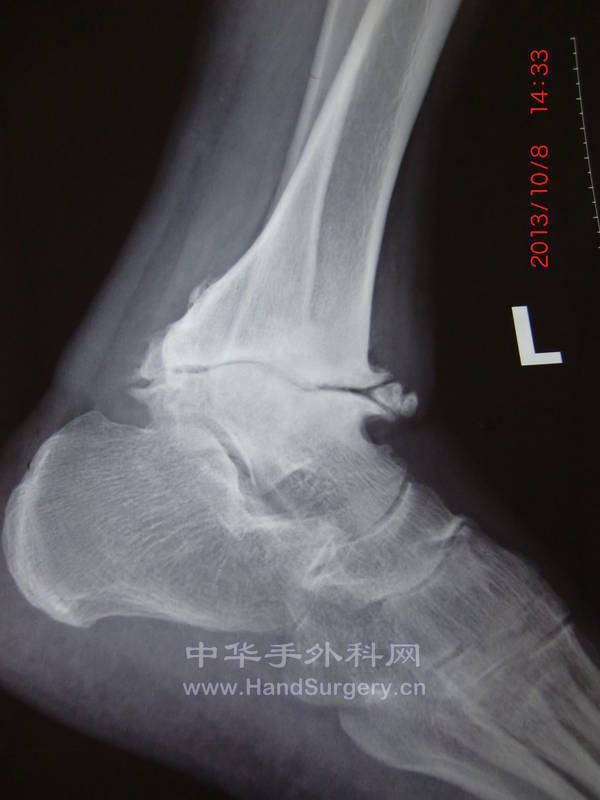 CIMG5704.JPG