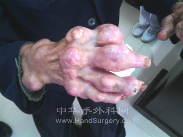 今天遇见的一个病人