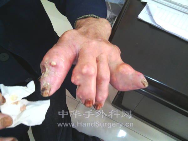 今天遇见的一个病人