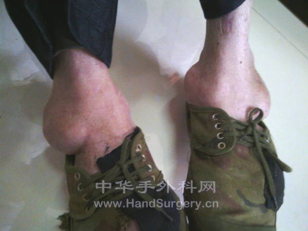 今天遇见的一个病人