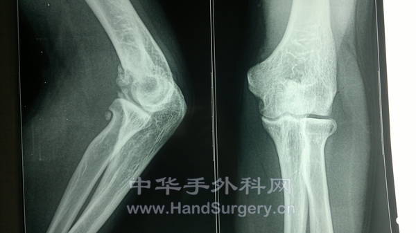 201310151987.jpg