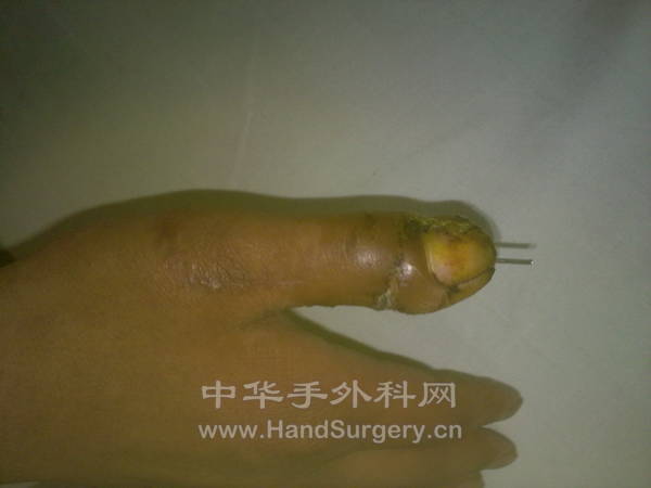20130507146.jpg
