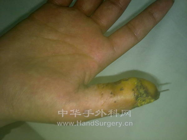 20130507147.jpg