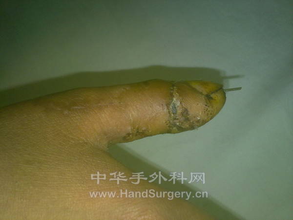 20130507149.jpg