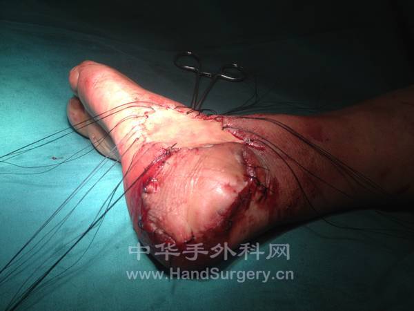照片 035.jpg