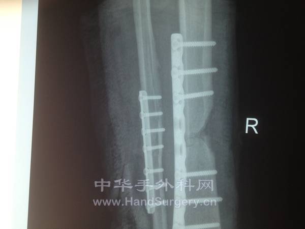 8月28x片放大