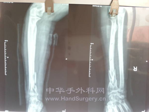 20131113_112241.jpg