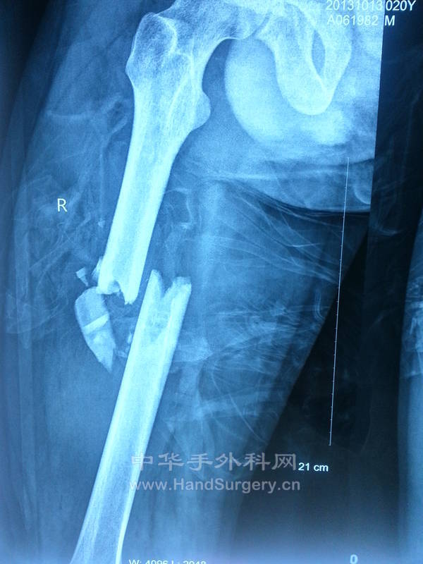 20131117_093241.jpg