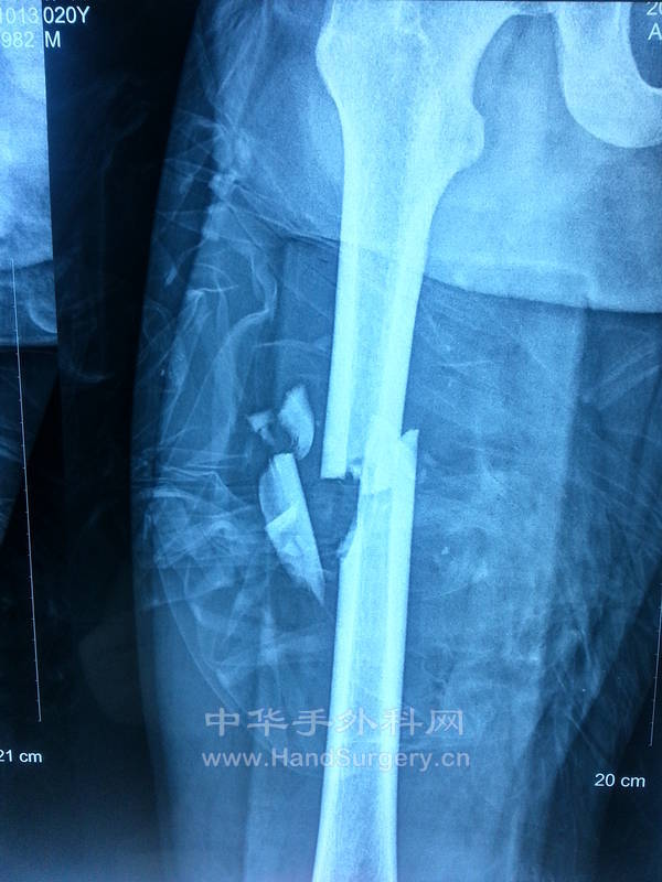 20131117_093247.jpg