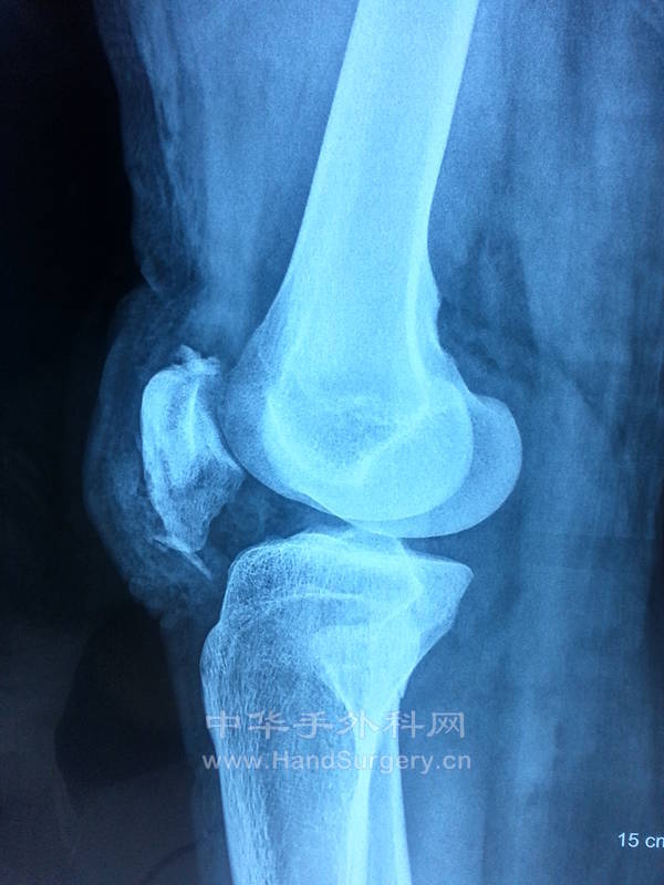 20131117_093341.jpg