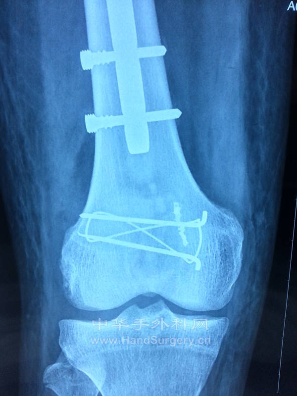 20131117_093356.jpg