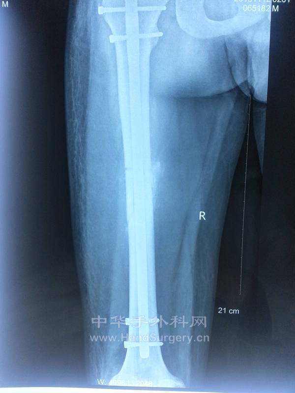 20131117_093509.jpg