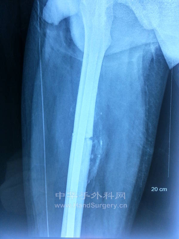 20131117_093517.jpg