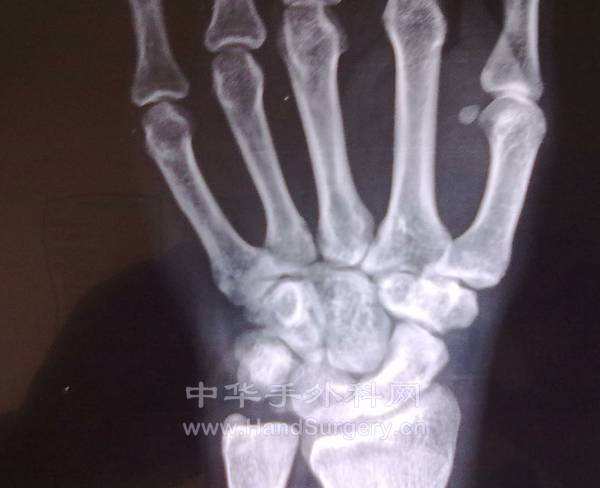 20131128304_2345看图王.jpg