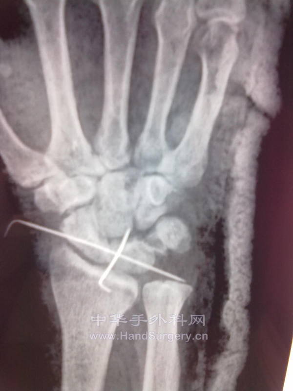 20131129313.jpg