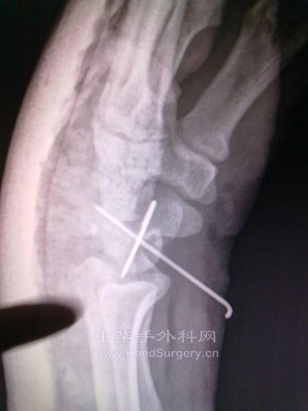 20131129311.jpg