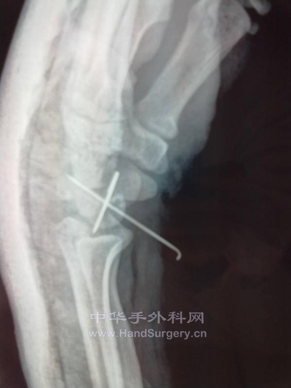 20131129312.jpg
