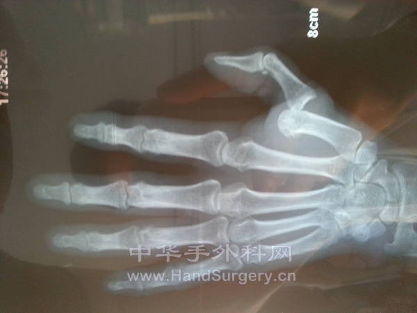20131117_085629.jpg