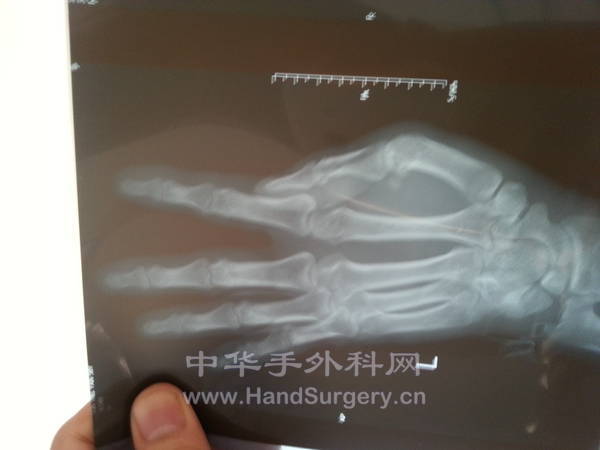 20131117_085642.jpg