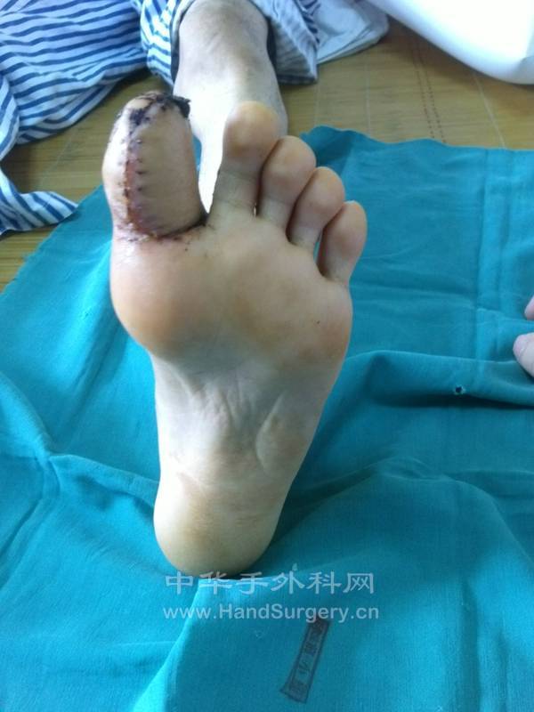 YP20130822093436.jpg
