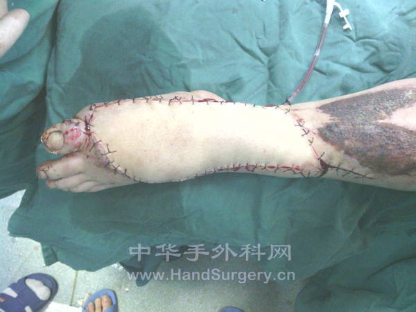 IMG_20111127_182950.jpg