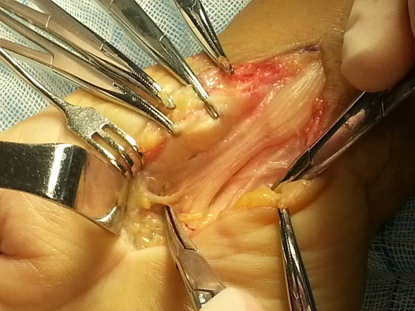 20140121_094220.jpg