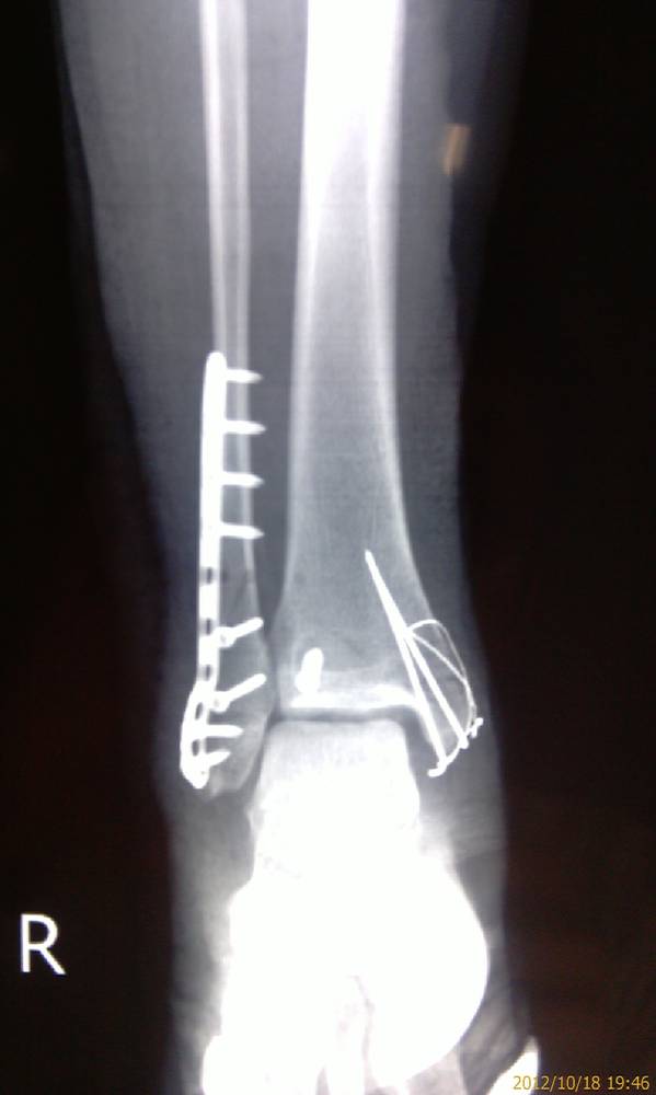 IMAG0291.jpg