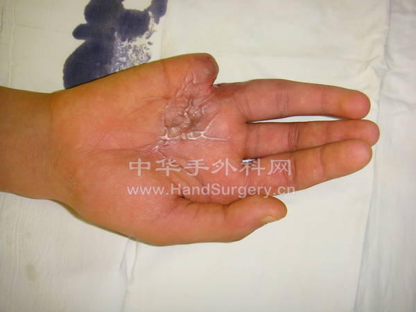 12月9日术前情况