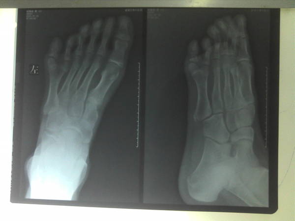 C360_2014-01-17-08-23-31.jpg