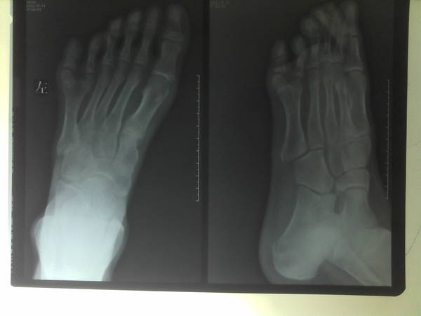 C360_2014-01-17-08-23-41.jpg