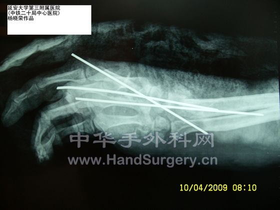SL731528.JPG