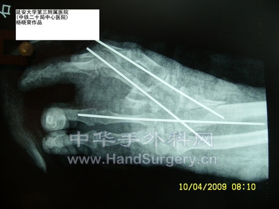 SL731529.JPG