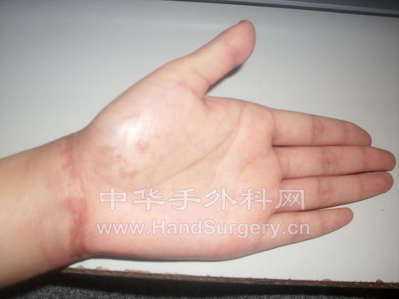 手心5.JPG