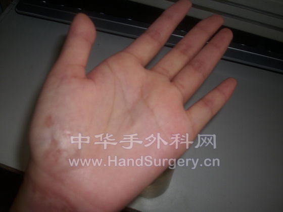 手心8.JPG