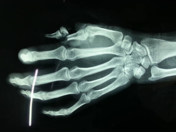 20140115_185721.jpg