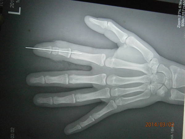 P3020008.JPG