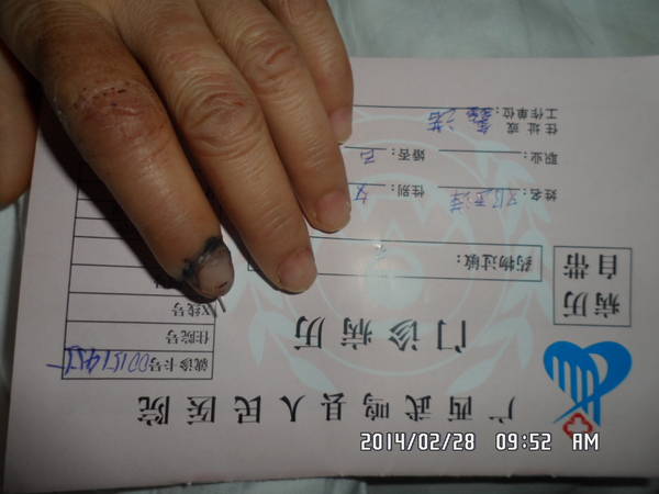 术后2周